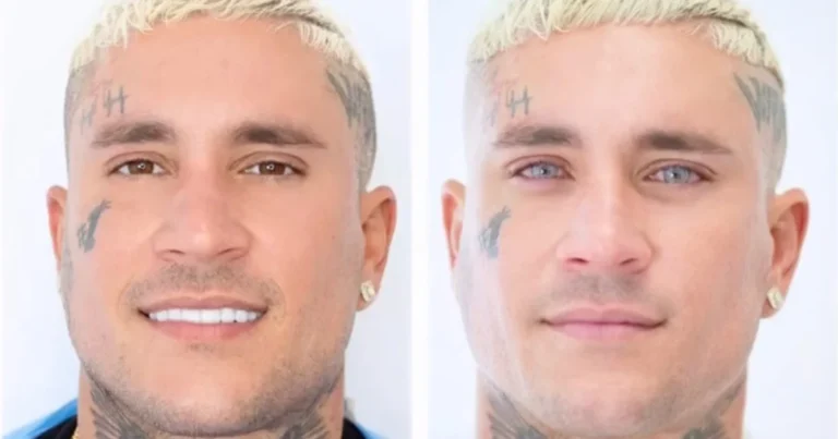 Osmani Garcia Cambio El Color De Sus Ojos, Ahora son Azules.